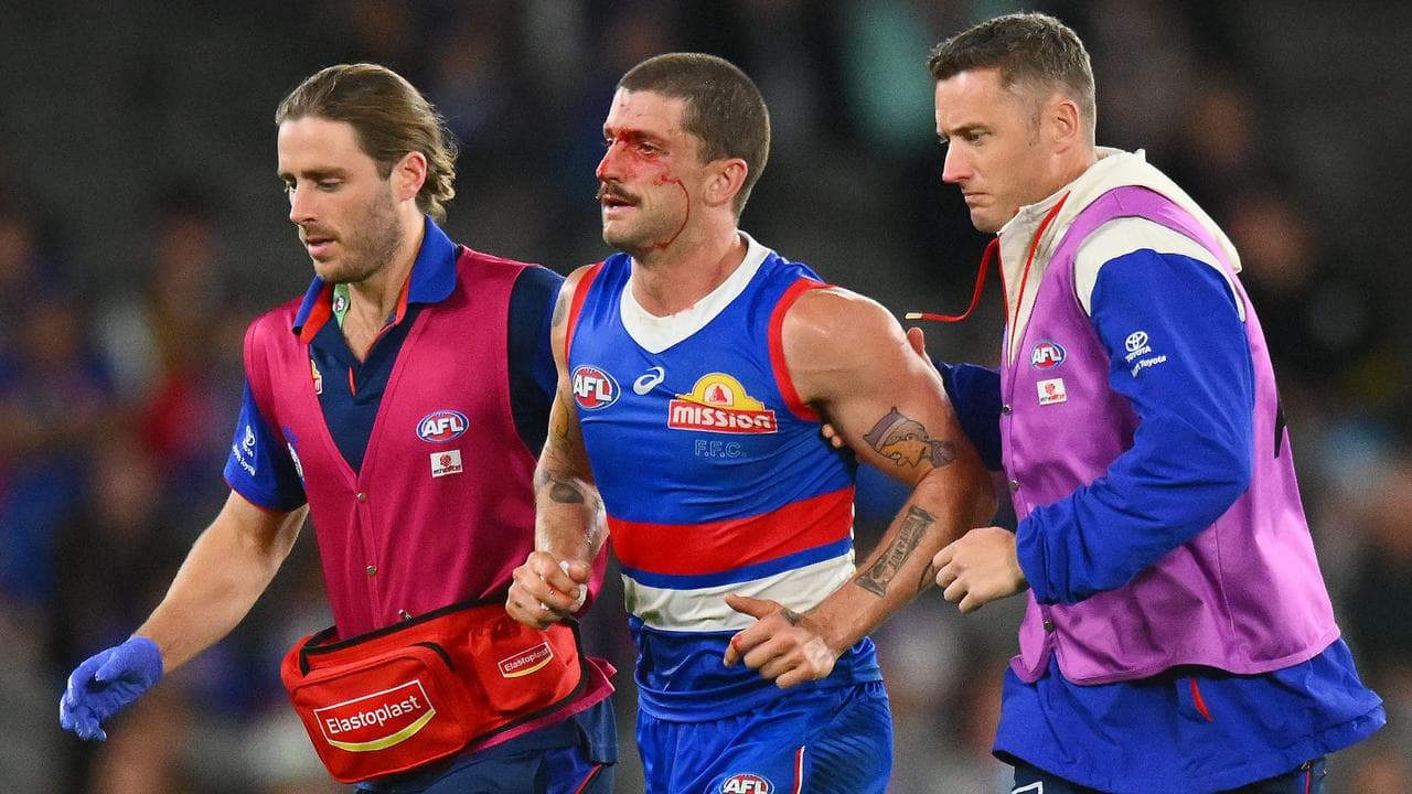 Tom Liberatore (centre).