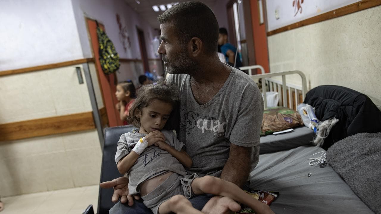 Over 7000 Gaza children malnourished