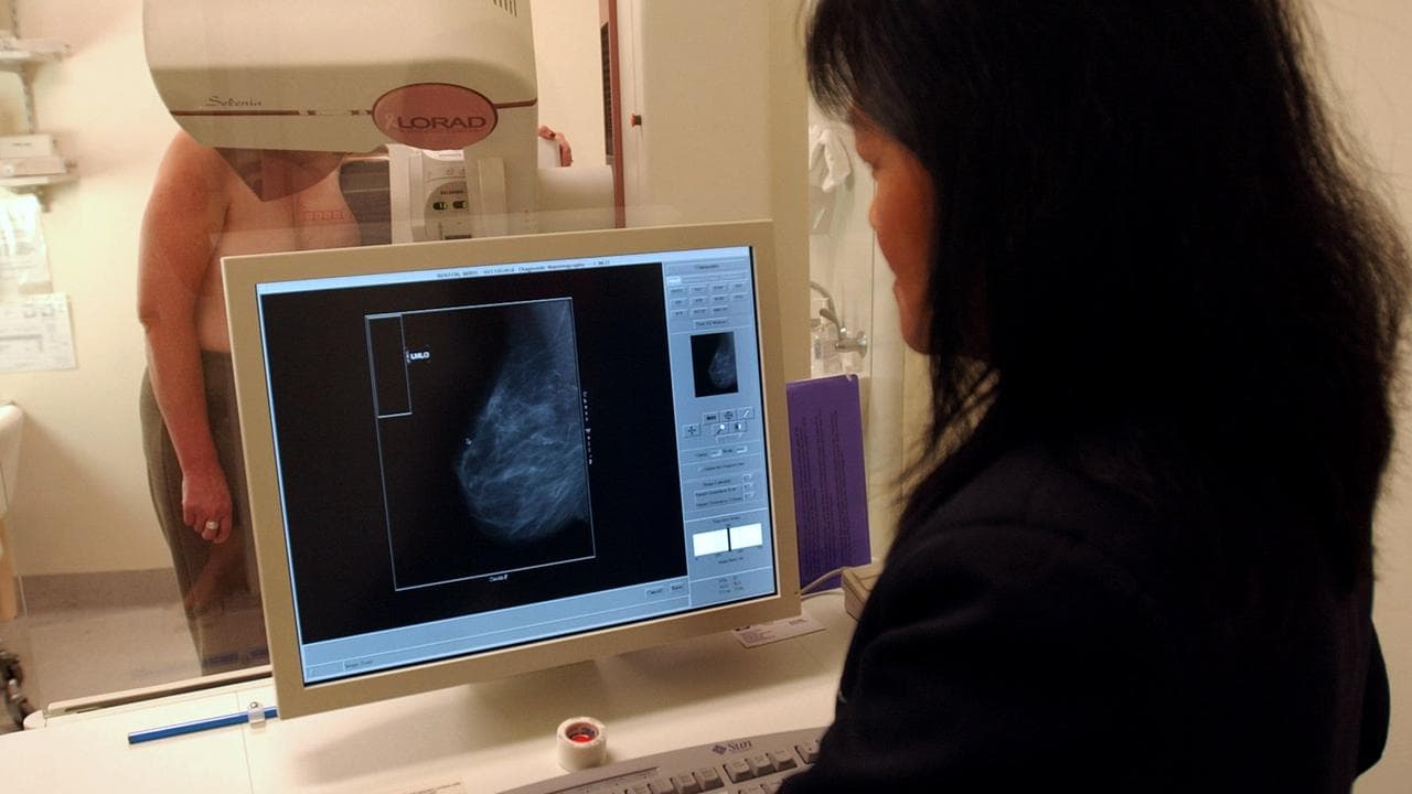 A radiographer performs a mammogram on patient (file image)