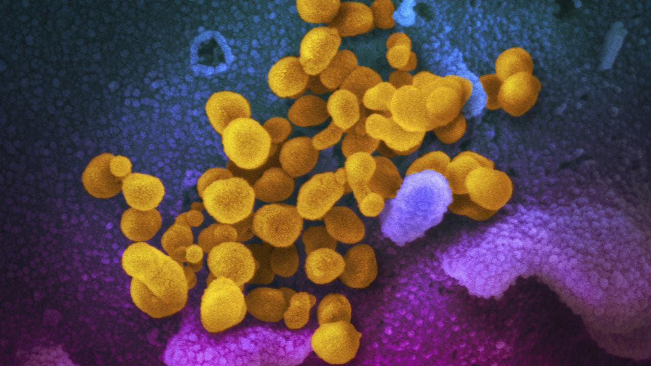 Microscope image of SARS-CoV-2 emerging from surface of cells