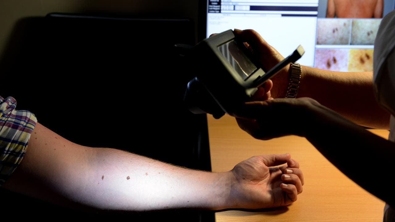 A patient being checked for skin cancers (file image)