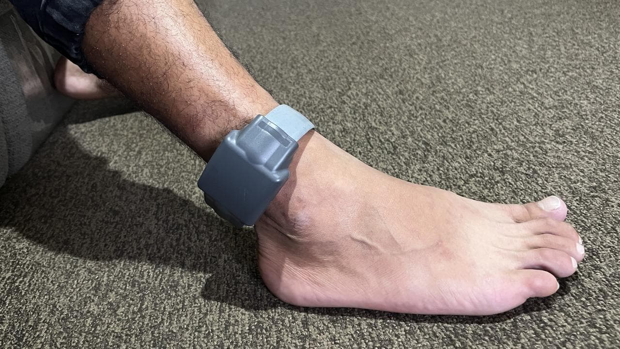 An electronic monitoring bracelet (file image)