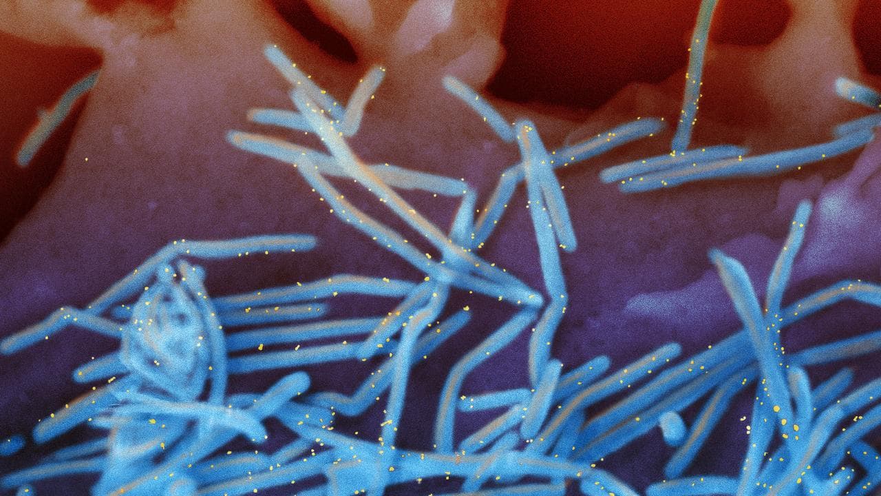 Electron microscope of RSV virions.