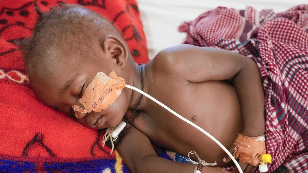 Salma IssaAbakar, 17 months old, rests in an MSF-run clinic