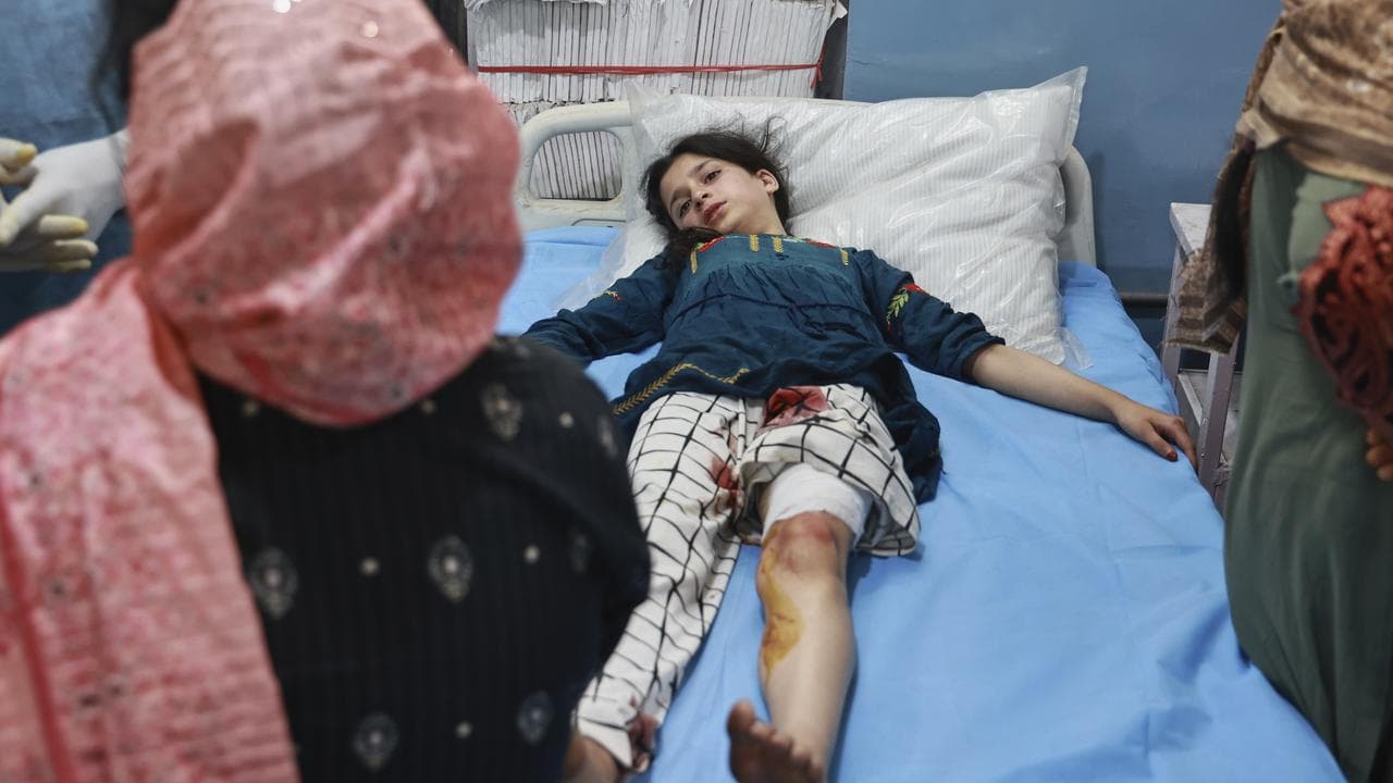 A girl wounded by shelling is treated in hospital in Indian Kashmir