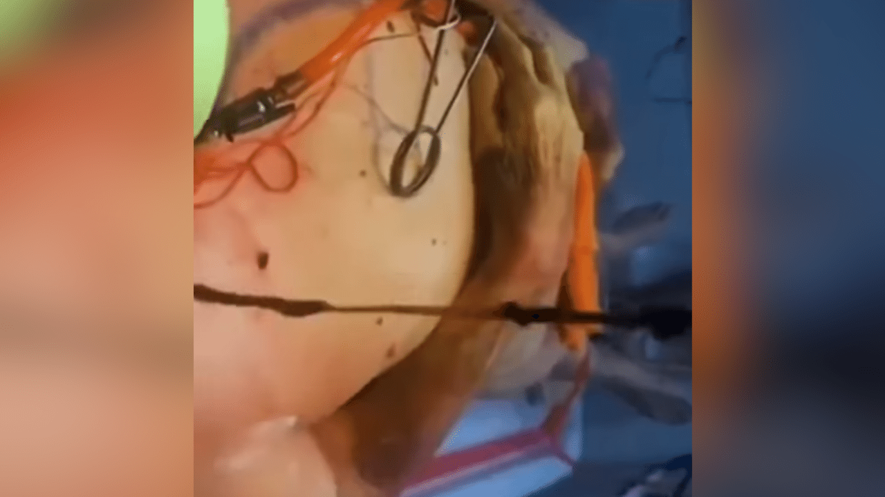 Gruesome imagery of clot removal included in deepfake Dr Tam video