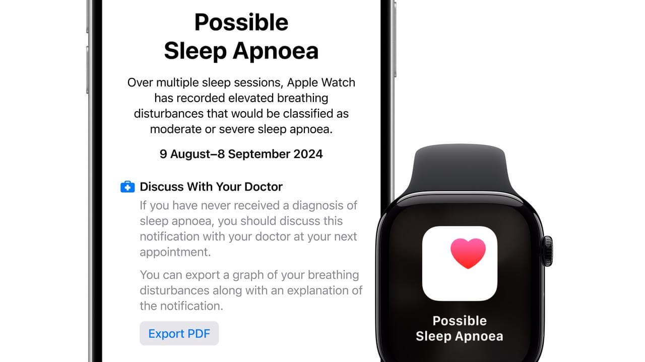 Smartwatch and phone 'possible sleep apnoea'