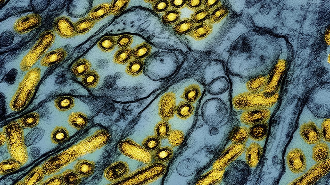 Electron microscope image of bird flu H5N1 virus particles (yellow)