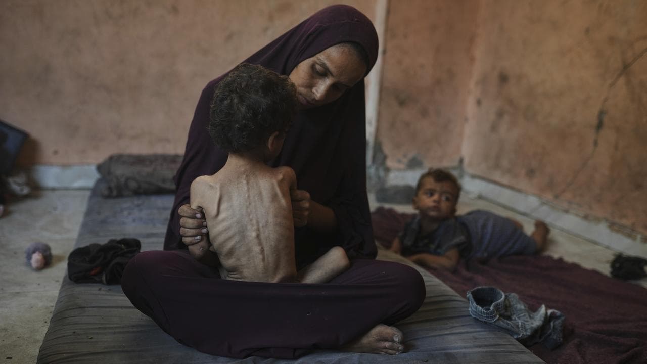 A mother holds her malnourished child at a home in Gaza City