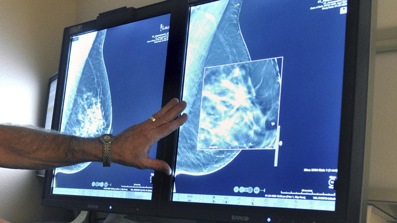 Mammogram images