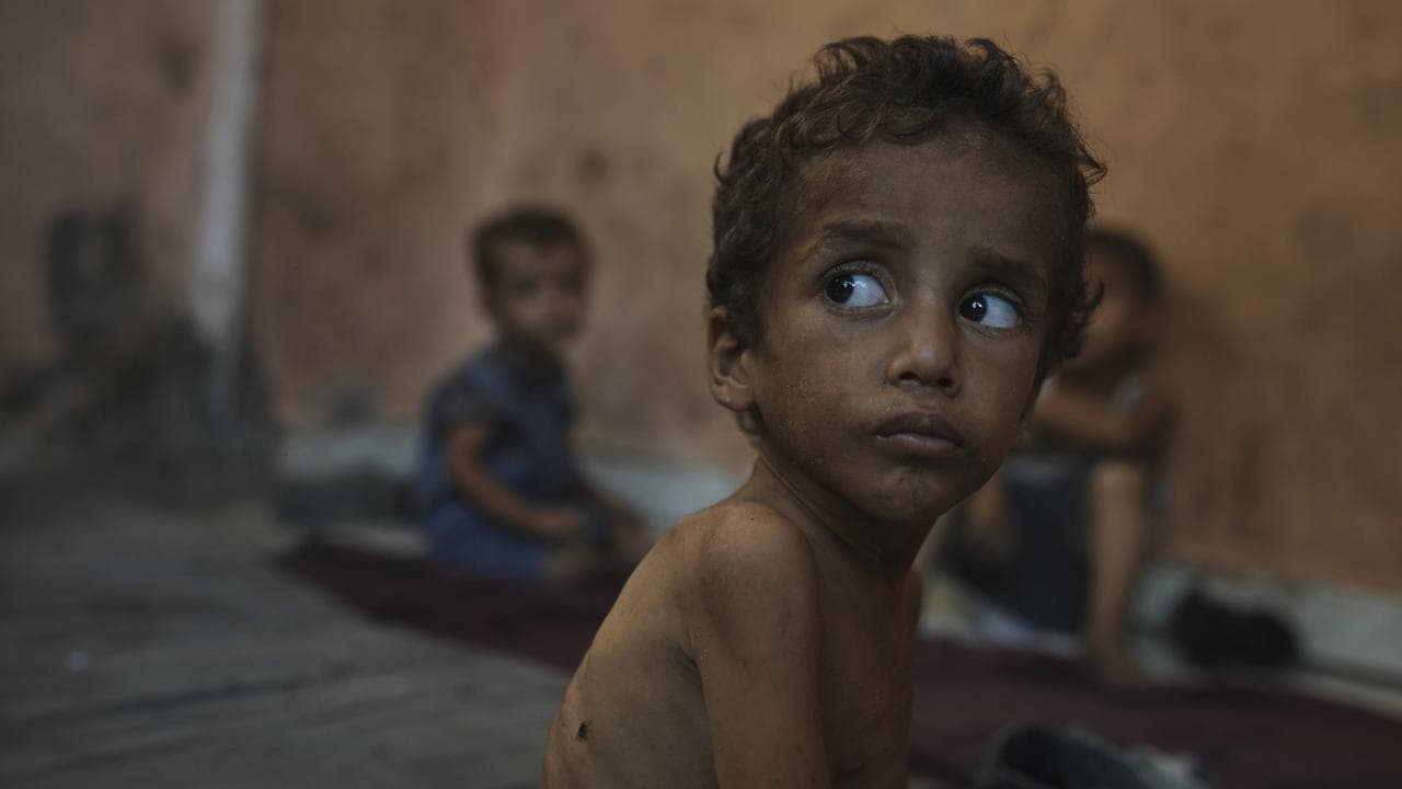 One of the original images taken of a child in Gaza, July 23, 2025.