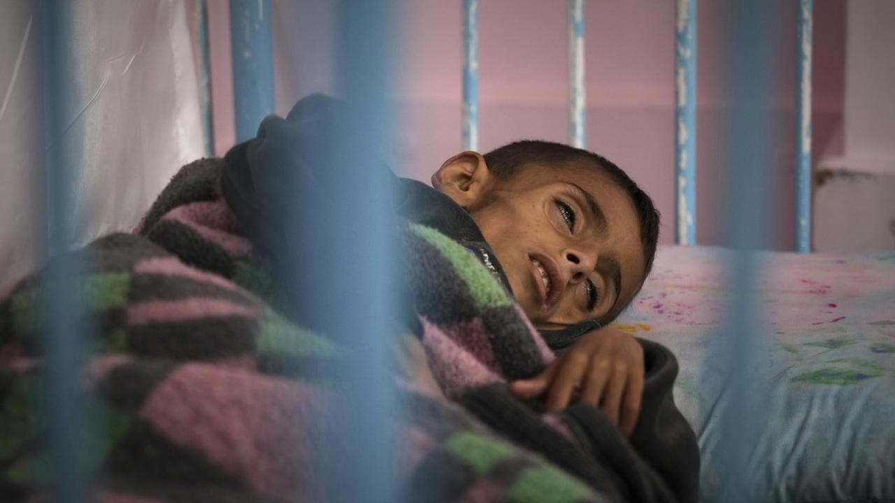 Malnourished Gazan boy Osama al-Raqab.