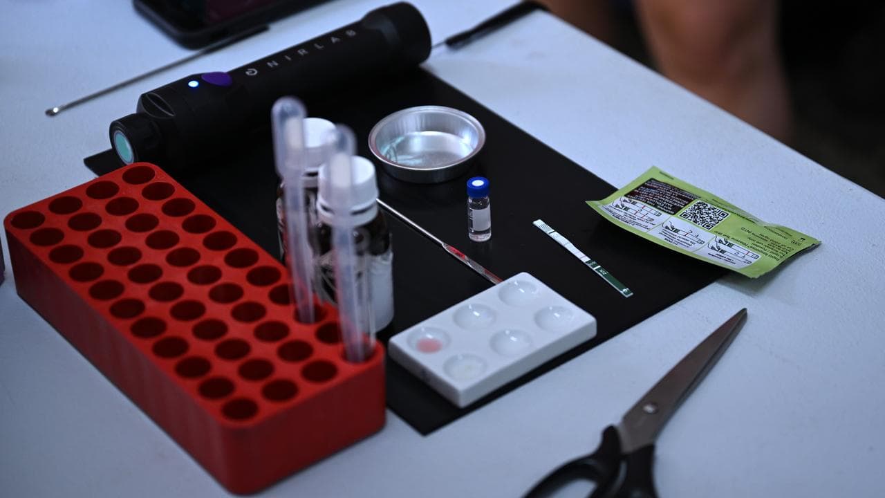 A pill testing site (file image)