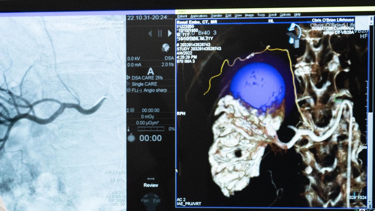 Interventional Oncology Operating Suites at Chris O’Brien Lifehouse