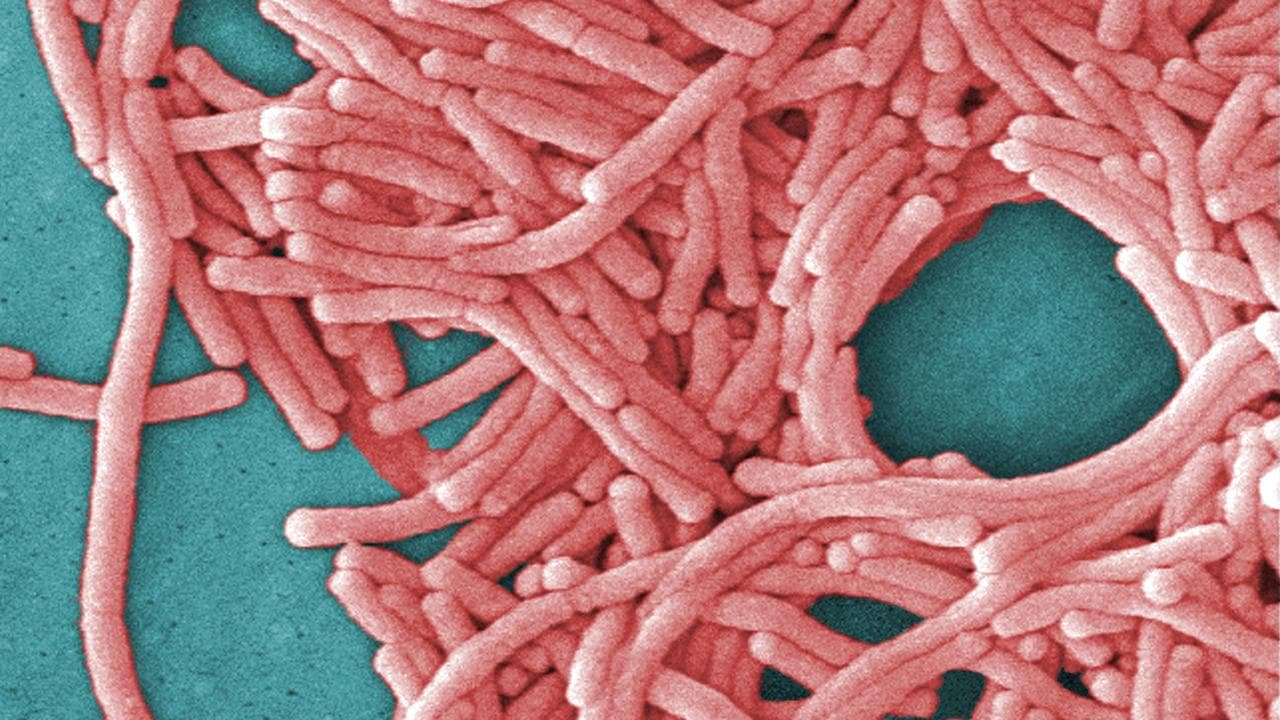 A file photo of Legionella bacteria