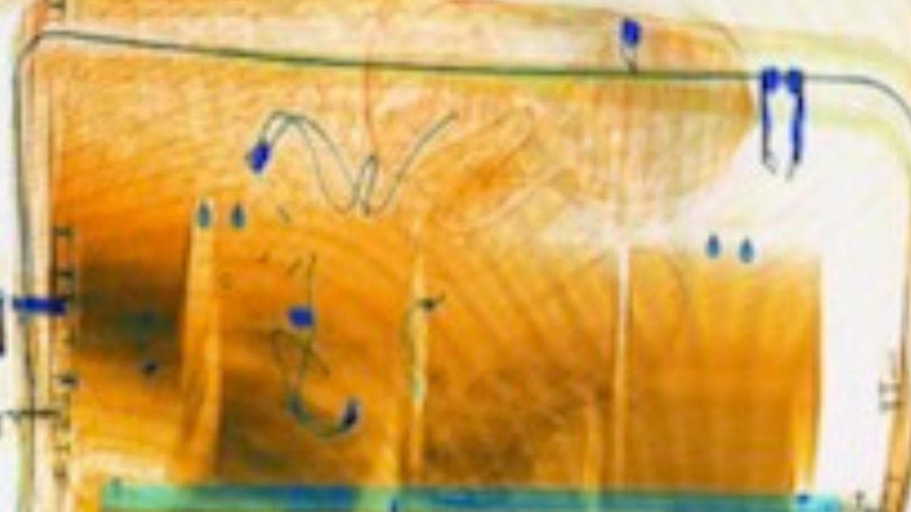 X-ray image of a suitcase