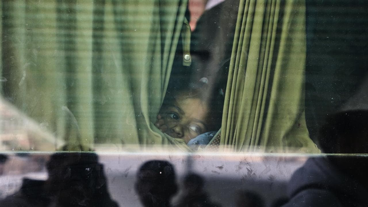 Juman a-Najjar, a three-year-old Palestinian patient