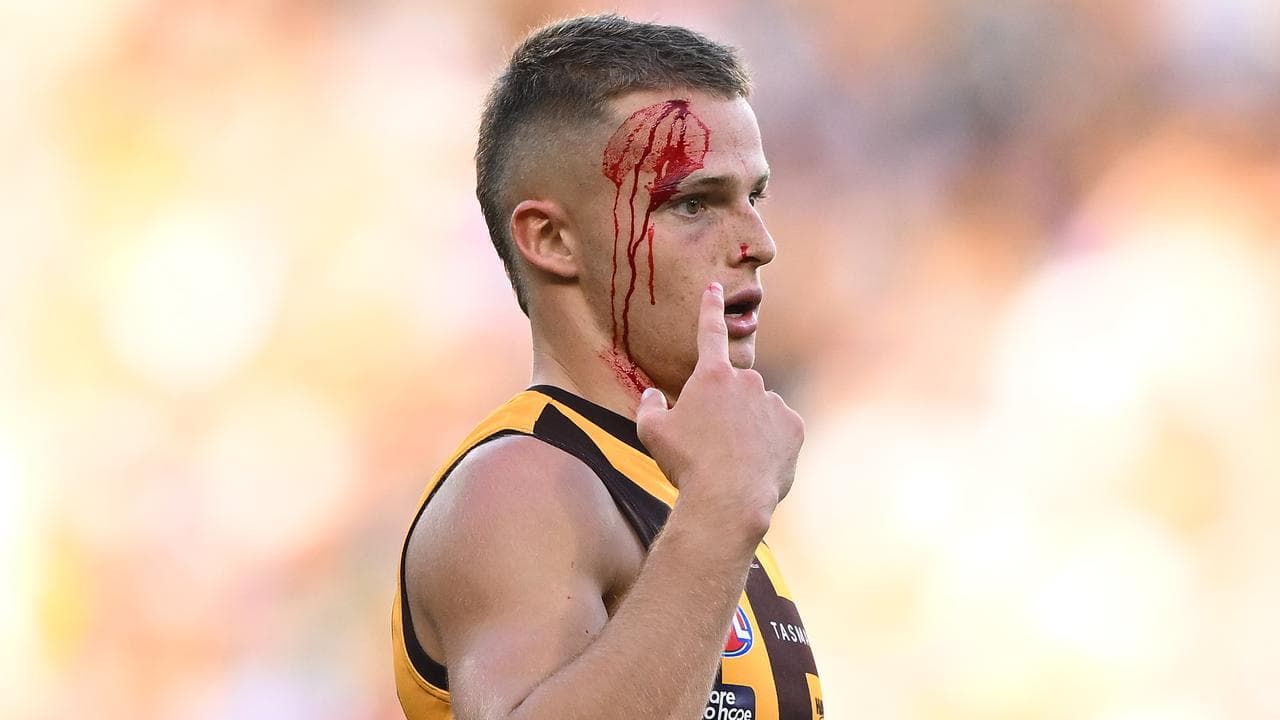 Jack Dalton of the Hawks