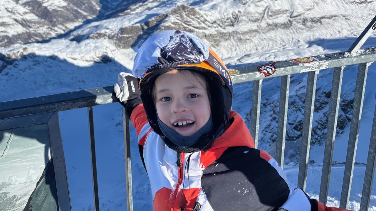 Food allergy sufferer Edward