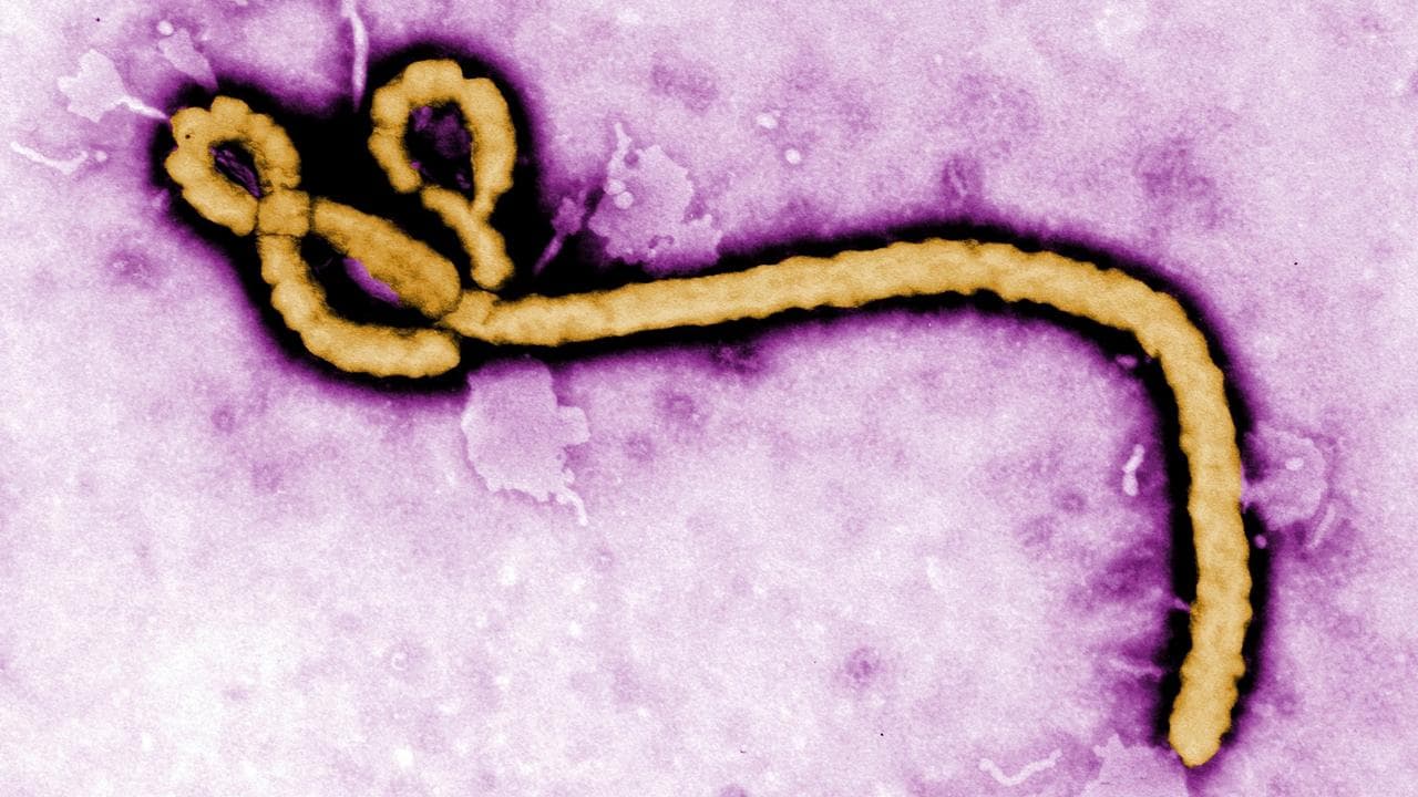 Electron micrograph image of an Ebola virus virion