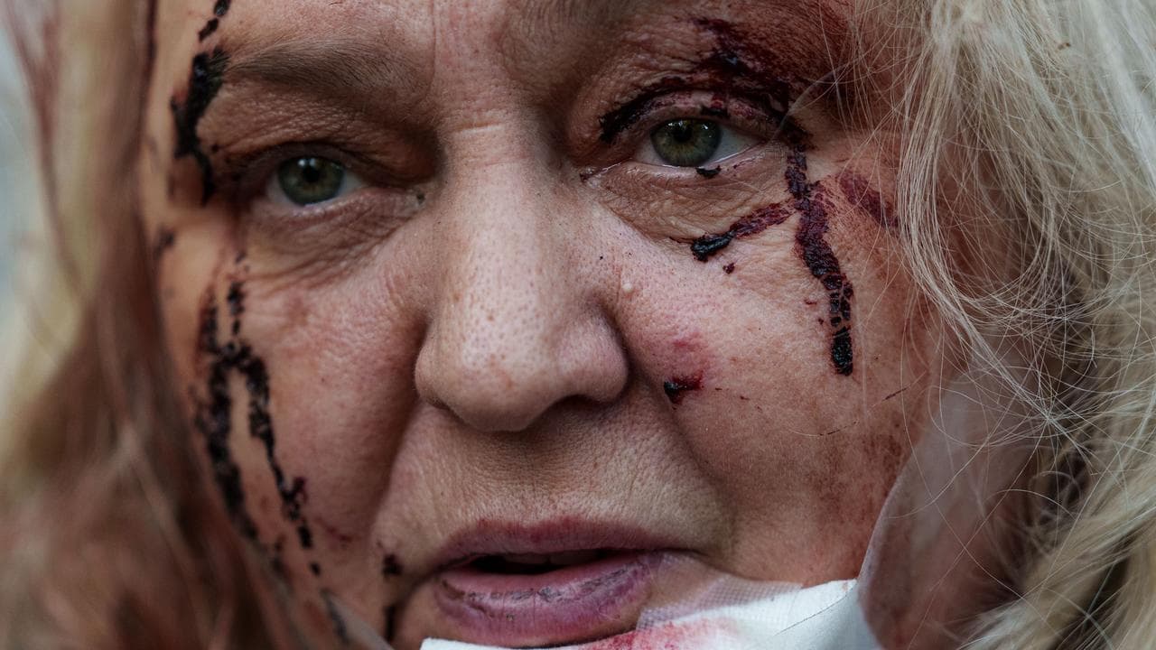 An injured Olena Dniprovska after a Russian strike in Kyiv, Ukraine