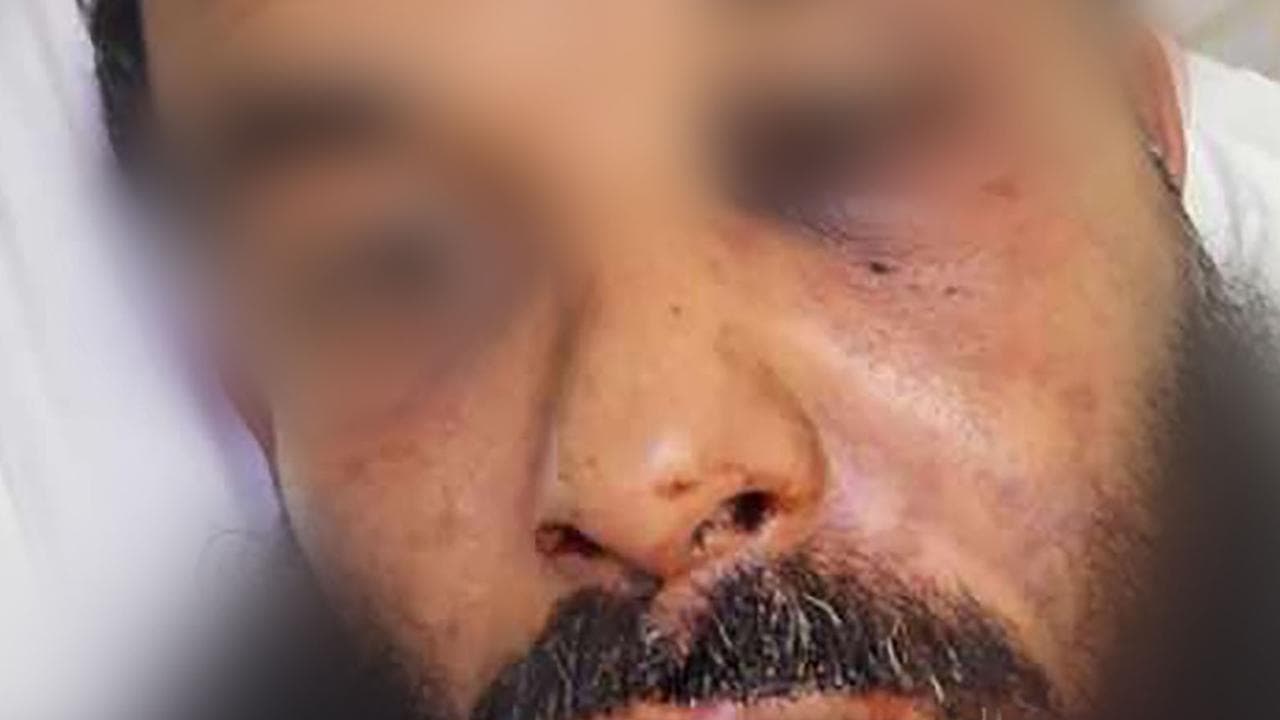 Photo of victim of assault