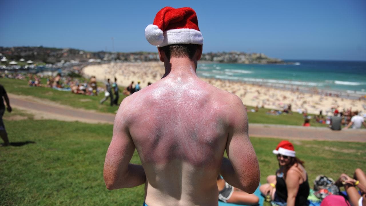 A sunburnt backpacker from Ireland at Bondi Beach on Christmas Day.