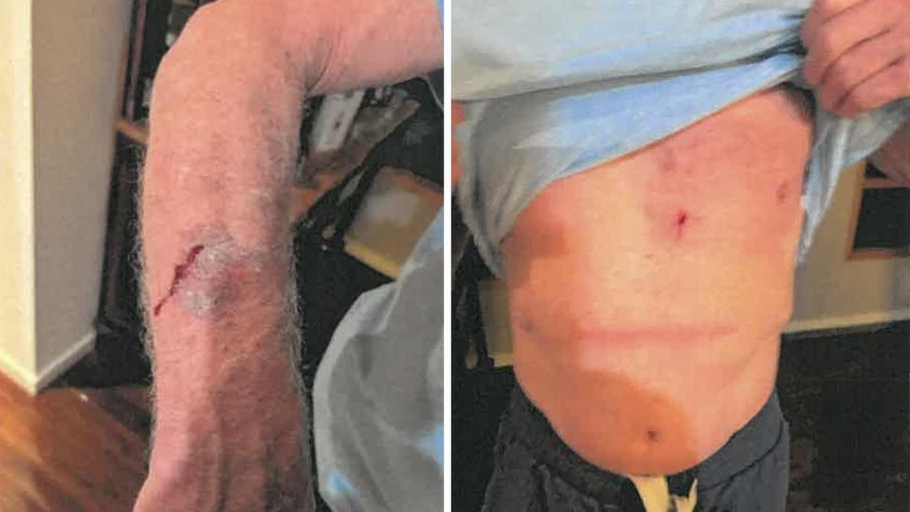 Malthouse injuries