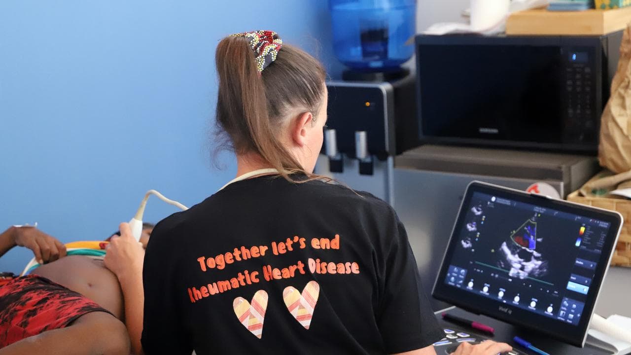 A heart scan