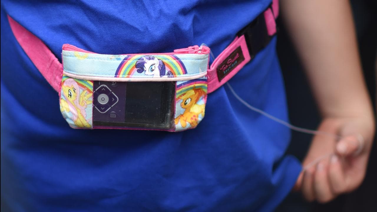 A girl suffering from type 1 diabetes wears a monitoring device.