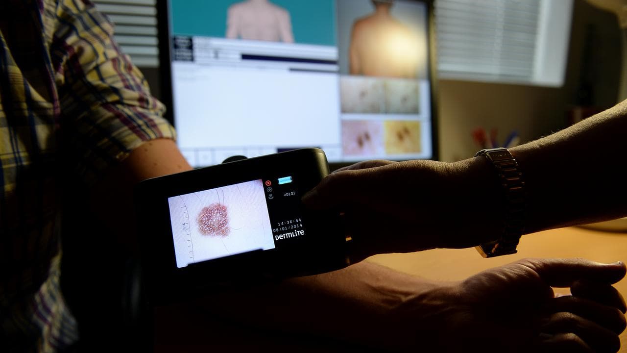 Aussie researcher's international cancer breakthrough