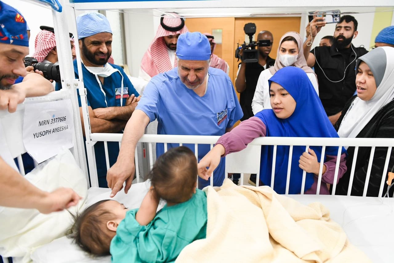 Successful Separation Surgery Gives Hope to Filipina Conjoined Twins in Riyadh