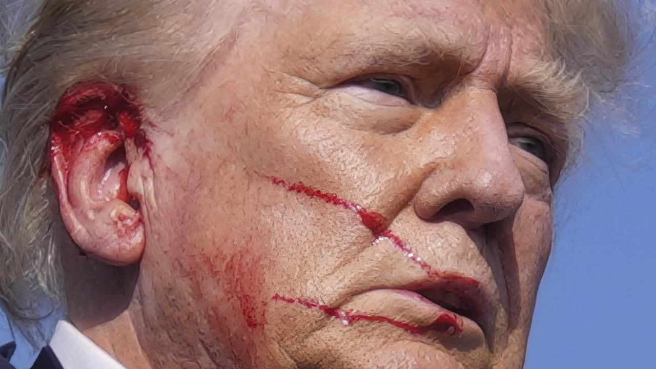 No, Donald Trump was not shot in the chest at rally
