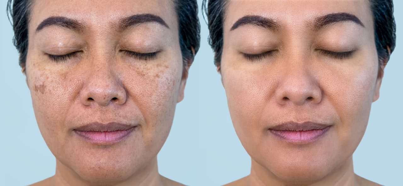 The Australian Photoageing Re.Port uncovers Australia's blind spot-on sun damage and skin health, taking unexpected emotional toll