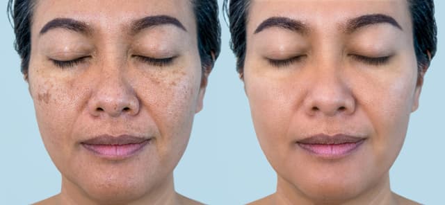 The Australian Photoageing Re.Port uncovers Australia's blind spot-on sun damage and skin health, taking unexpected emotional toll