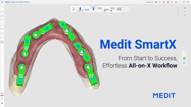 Revolutionizing All-on-X: Medit's Game-Changing Workflow Will Launch Soon