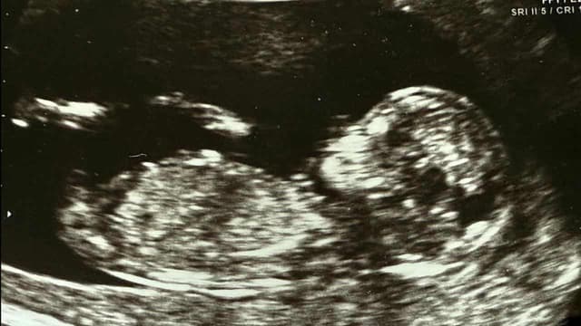 Spotlight on IVF regulation over embryo mix-up