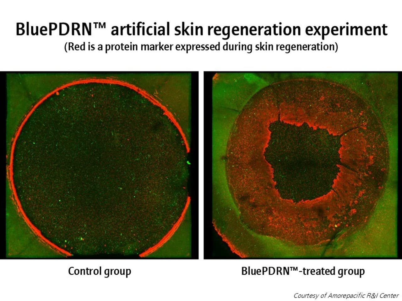 Amorepacific Research Confirms Potential of Microalgal-Derived PDRNs in Skin Regeneration and Wound Healing