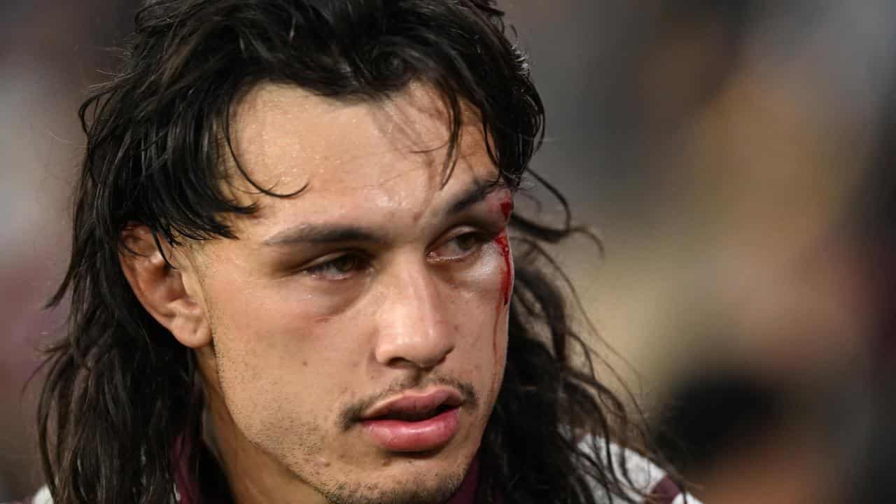 Titans make call on Tino after nasty eye injury