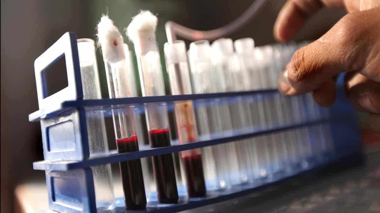 HIV transmission in Papua New Guinea at crisis levels