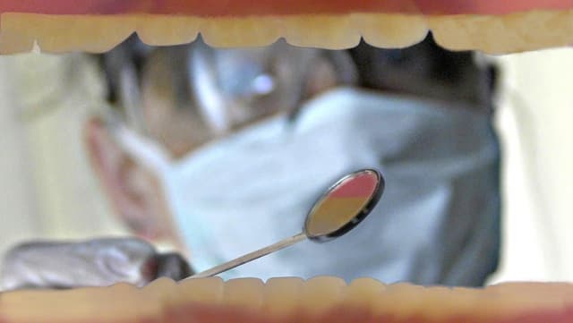 Dentists urged not to promote early super extractions