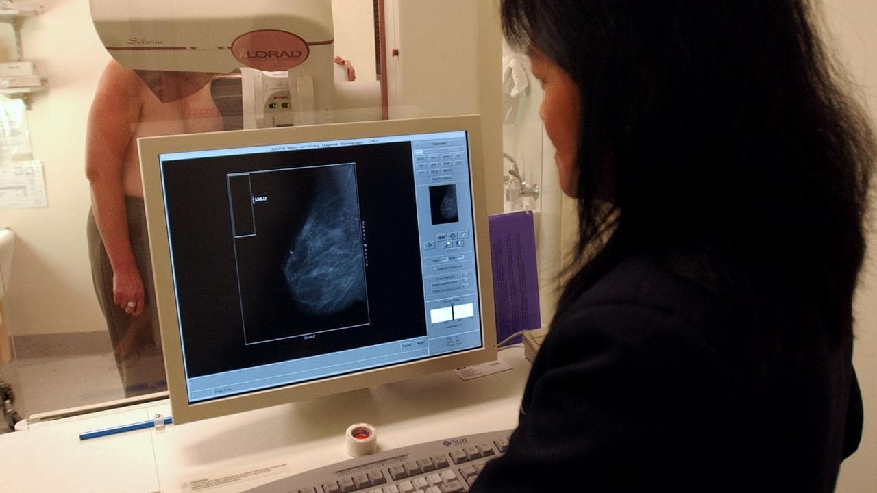 No truth to mammogram service suspension claims