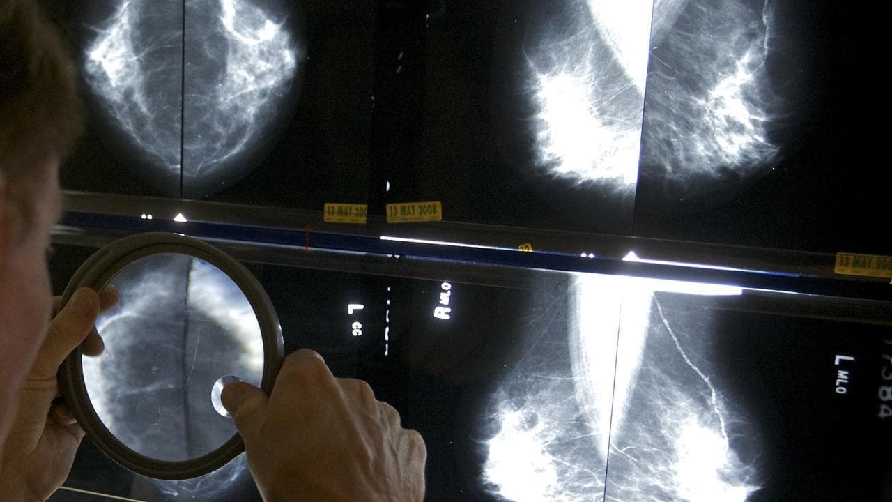 Hidden breast cancer costs increase burden of disease