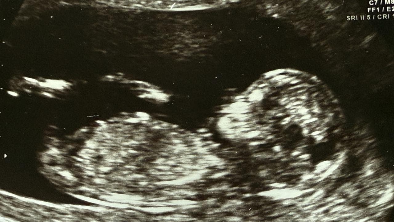 IVF giant again in play after new bid pumps up shares