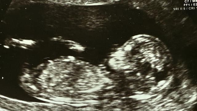 IVF giant again in play after new bid pumps up shares
