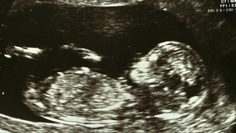 IVF giant again in play after new bid pumps up shares