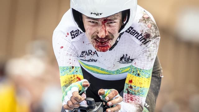 Broken elbow, concussion for Vine in Giro-ending crash