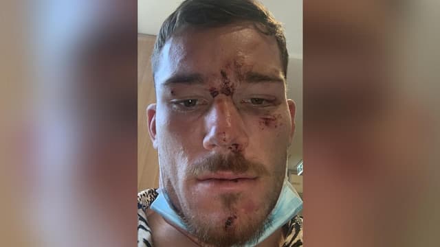 Conflicting claims as cops fight NRL star assault case