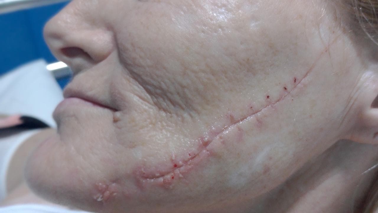 'Cackling': psychotic attacker stabs woman in her bed
