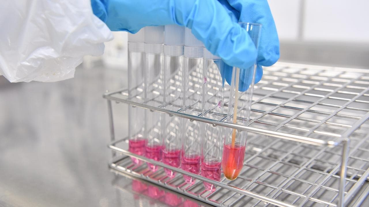 Deadly bird flu strain a 'serious concern' for wildlife